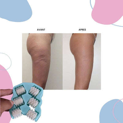 Pack S.O.S Anti-Cellulite